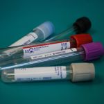 Coronavirus : les transfusions de plasma efficace contre la maladie